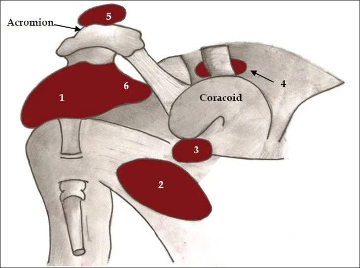 bursae-shoulder-joint-normal_orig